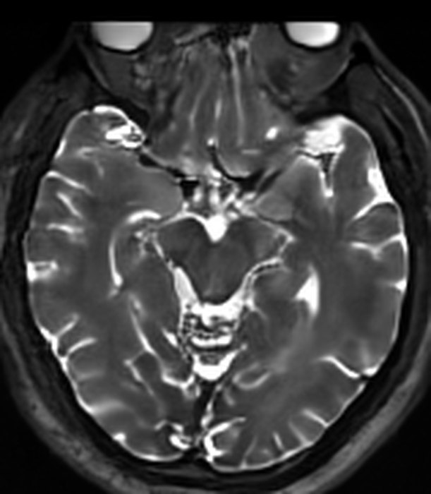 A synthetic T2-weighted brain MR slice, generated by AI.