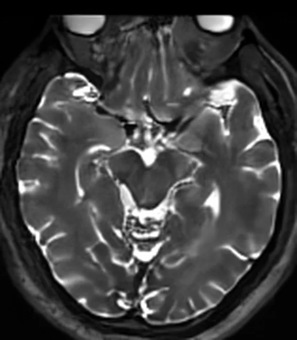 A synthetic T2-weighted brain MR slice, generated by AI.