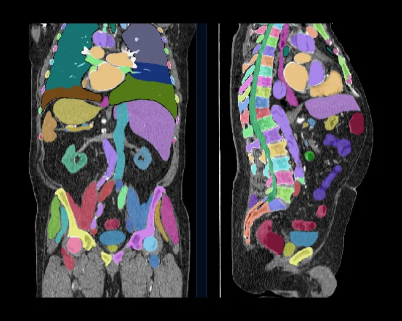 An automatic whole-body CT segmentation shown coronally and sagittally, with organs, vessels and every vertebra labelled in its own colour.