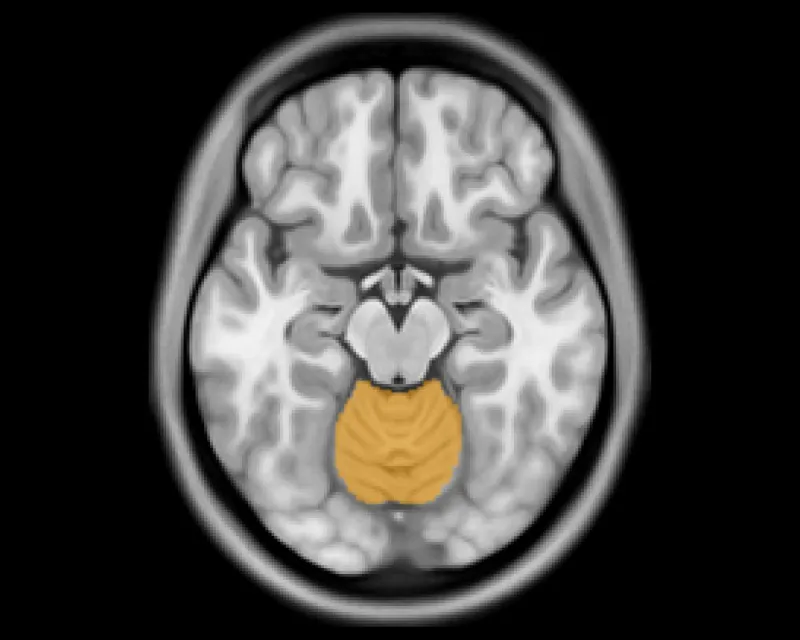 A brain MR with the cerebellum outlined in orange by the click-guided AI.