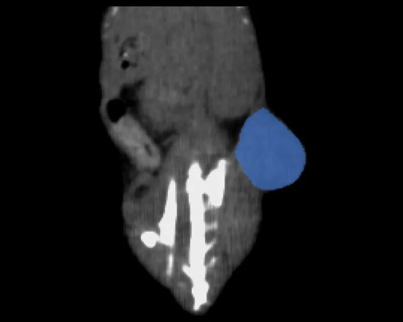 A whole-body mouse CT with a flank tumour filled in blue by the click-guided AI.