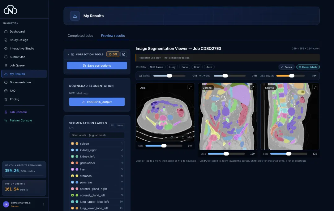 Preview results — axial, coronal and sagittal views with toggleable labels on an abdominal CT